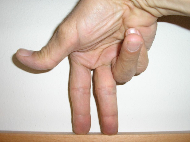 ergonomia